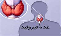 میزان ابتلای زنان به تیروئید پنج تا ۱۰ برابر مردان است